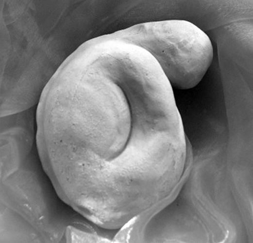 Embryo